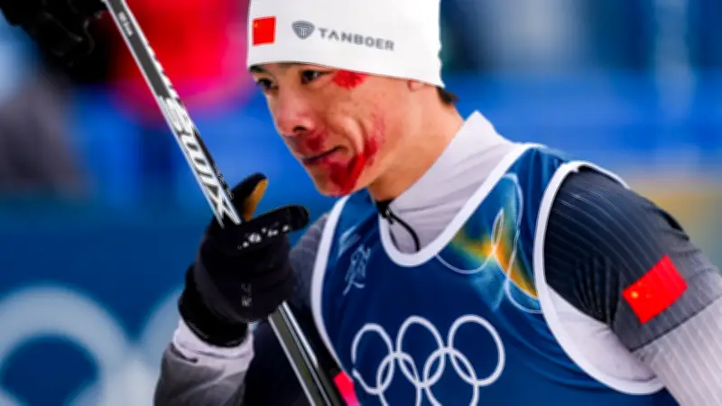 Deutscher Team-Arzt leistet Erste Hilfe bei Olympia: Blutiger Sturz von Chinas Kombinierer