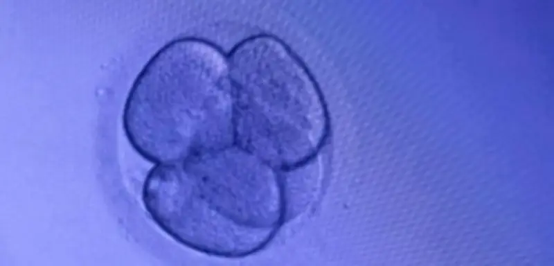 Embryonenschutzgesetz: Ungerechtigkeit bei Samen- und Eizellenspende in Deutschland