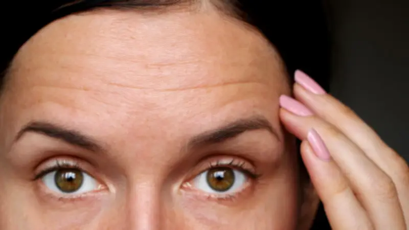 Faltenbehandlung in Köln: Botulinumtoxin als sanfte Methode für glatte Haut