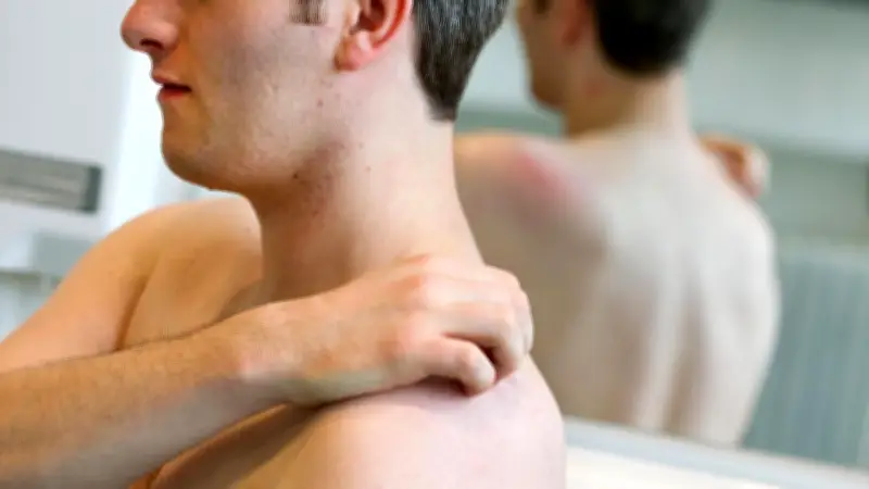 Krätze in Vorpommern: 14 Fälle gemeldet, aber keine lokalen Häufungen bestätigt