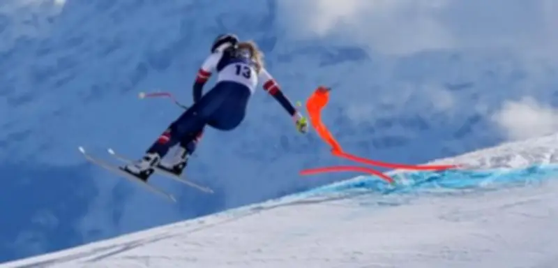 Lindsey Vonn: Bein-OPs verhinderten Amputation nach Olympia-Sturz