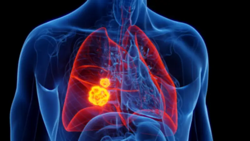 Luftverschmutzung als Krebsrisiko: Immer mehr Nichtraucher erkranken an Lungenkrebs