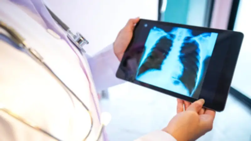 Ab April 2026: Kostenloses Lungenkrebs-Screening für starke Raucher startet in Deutschland