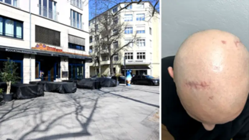 Berliner Prügelattacke: Opfer mit Hirnblutung kämpft um Genesung - Täter weiter flüchtig