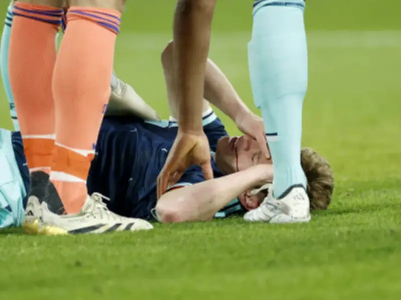 Blutige Szene bei DFB-Testspiel: Joshua Kimmich erleidet Ellenbogen-Treffer