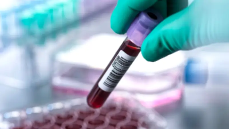 Bluttest auf Vitamine: Lohnt sich die Investition für Ihre Gesundheit wirklich?