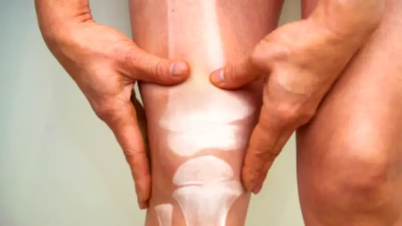 Fibrodysplasia ossificans progressiva: Wenn der Körper sich selbst versteinert