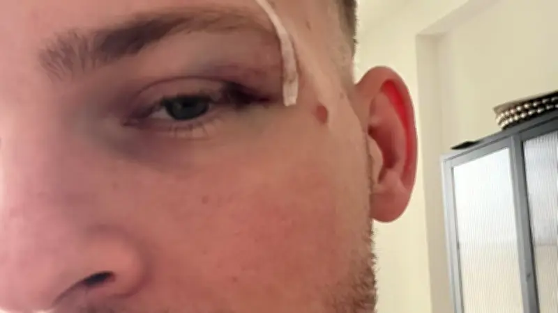 Lok Leipzigs Torjäger Maderer: „Wie nach einer Schlägerei“ – Verletzung nach Kopfball-Duell