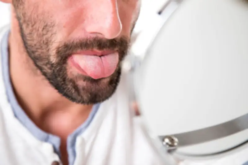 Mundsoor bei Erwachsenen: Ursachen, Symptome und wirksame Behandlungsmethoden