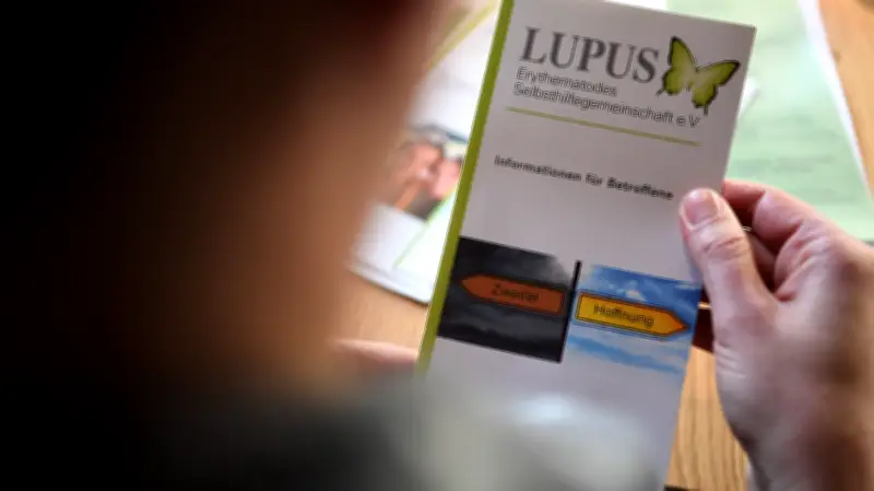 Neubrandenburger Klinikum informiert über Lupus: Therapien und Alltagsbewältigung
