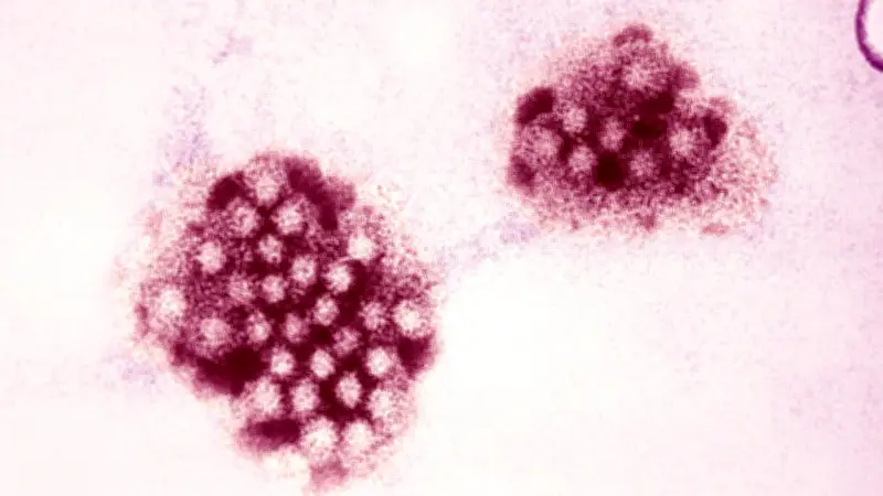 Norovirus-Ausbruch in hessischem Hotel: 13 Personen im Krankenhaus behandelt