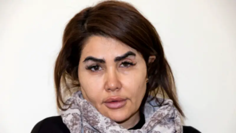 Prozess um Schönheits-OP-Pfusch: Patientin klagt über dauerhafte Entstellung