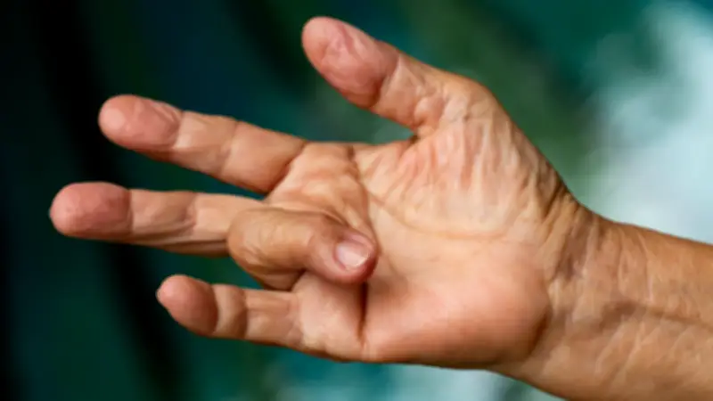 Schnappfinger am Morgen: Ursachen erkennen und effektive Behandlungsmöglichkeiten