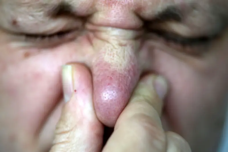 Wildenborn: Bürger wehren sich gegen nächtliche Geruchsbelästigung durch Biogasanlage