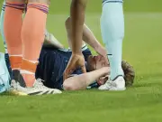 Blutige Szene bei DFB-Testspiel: Joshua Kimmich erleidet Ellenbogen-Treffer