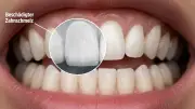 Deutsche Filler-Technologie revolutioniert Zahnaufhellung: Weißere Zähne durch Schmelzstärkung