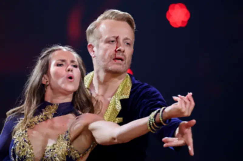 Blutiger Ellenbogen-Treffer bei Let's Dance: Ross Antony tanzt trotz Verletzung weiter