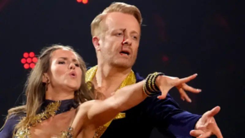 Blutiger Vorfall bei Let's Dance: Ross Anthony tanzt trotz Verletzung weiter