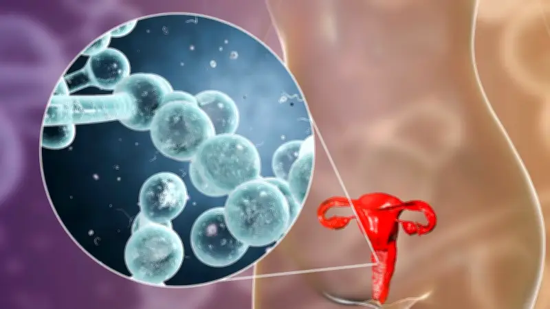 Gynäkologin: Anzeichen einer bakteriellen Vaginose erkennen