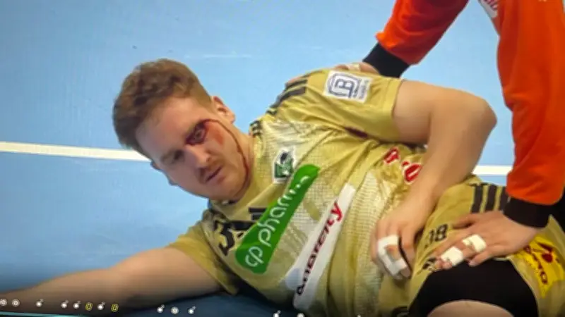 Handball-Bundesliga: Blutige Szenen überschatten Sieg von Hannover-Burgdorf in Eisenach