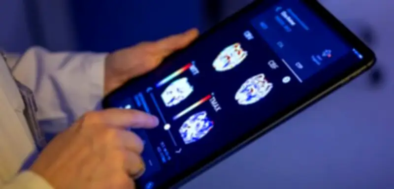 KI übertrumpft Ärzte: Harvard-Studie zeigt bessere Diagnosen