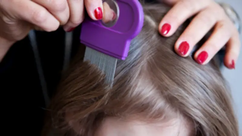 Kopfläuse-Befall in Schleswig-Holstein rückläufig: So bekämpfen Sie die Parasiten effektiv