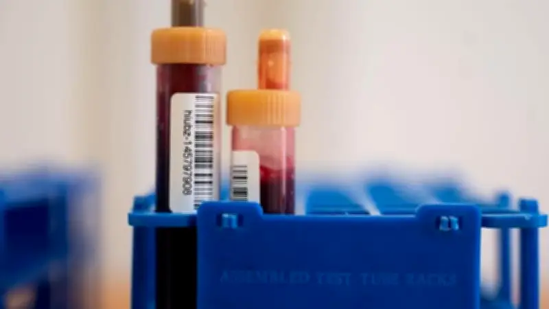 Köthen: 52-Jähriger leistet Widerstand gegen Blutentnahme in Helios-Klinik