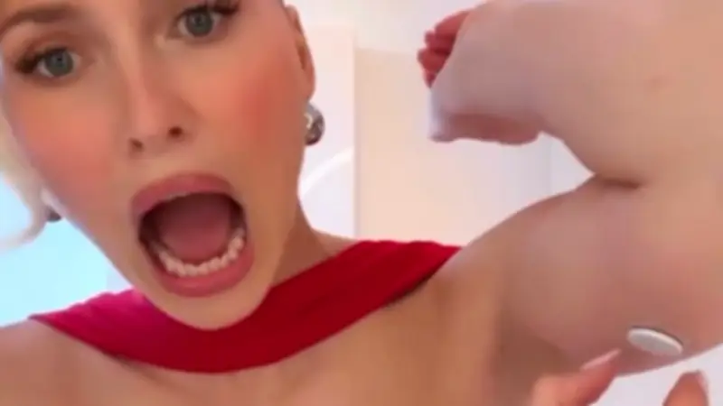 Lena Gercke entfernt Diabetes-Sensor für Abend-Outfit