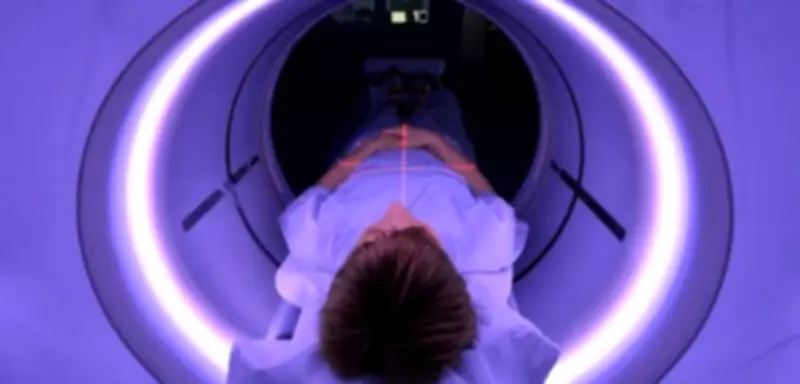 Lungenkrebs-Früherkennung für Starkraucher: Hoffnung und Scham im Fokus