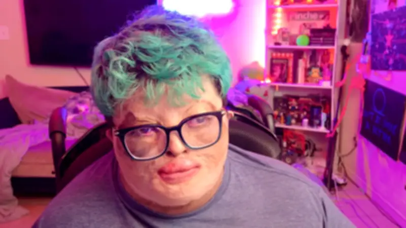 Nur ein Prozent Überlebenschance: Wie ein Horror-Unfall das Leben von Gaming-Influencer Josh für immer veränderte