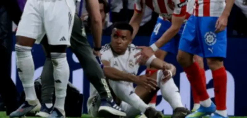 Real Madrid schont vor Bayern-Rückspiel und verpasst Sieg gegen Girona