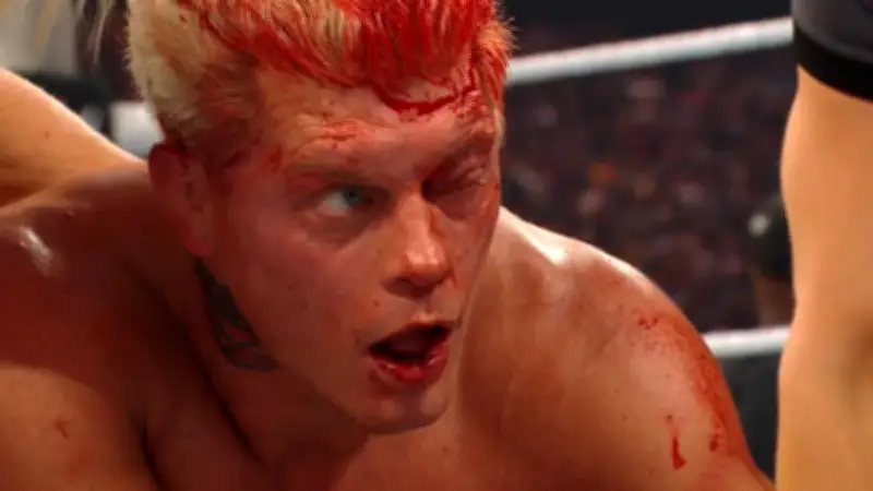 WWE-Champion Cody Rhodes: Schockierender Anblick nach WrestleMania