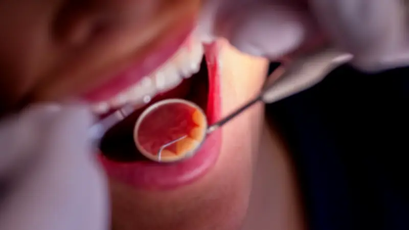 Zahnärztemangel in MV: Jeder Fünfte vor Rente - Land sucht dringend Nachfolger