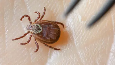 Zecken-Alarm in Deutschland: Todesfälle durch Borreliose und FSME steigen deutlich an