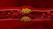 Jenaer Studie: Neuer Cholesterin-Tiefstwert schützt Ihr Herz besser