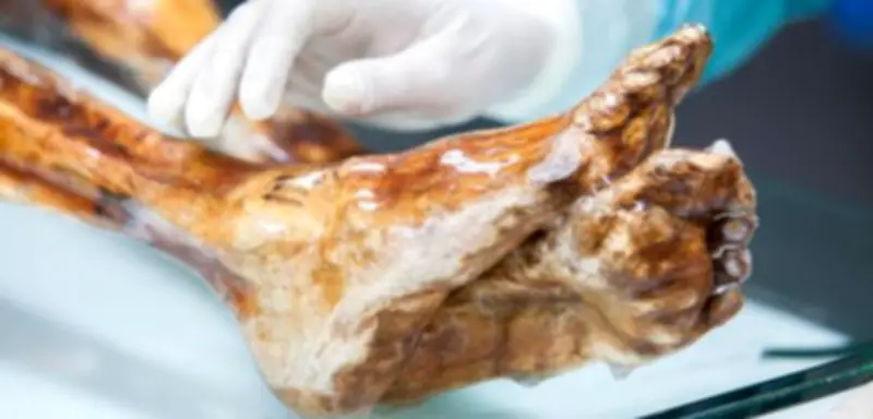 Ötzi in Gefahr? Bakterien und Pilze bedrohen die Gletschermumie