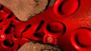 Cholesterin-Irrtümer: Experte klärt über die 8 größten Mythen auf