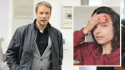 Oliver Pochers Sohn (6) verliert bei Sturz beide Schneidezähne