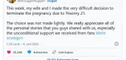 YouTuber-Paar treibt Baby mit Downsyndrom ab und erntet Shitstorm