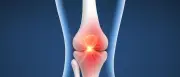 Arthrose heilbar? Stanford-Forscher verjüngen Knorpelzellen mit neuem Wirkstoff